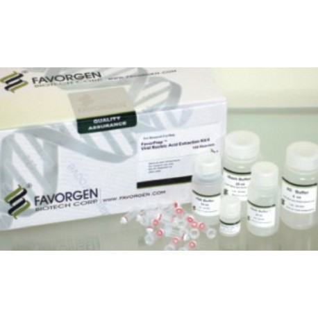 Viral Nucleic Acid Extraction Kit II  (100prep)