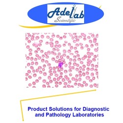 Product Solutions for Diagnostic and Pathology Laboratories