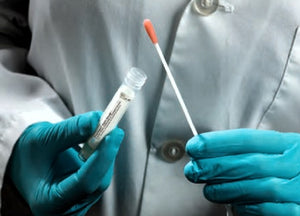 Specimen Collection & Diagnostic Swabs
