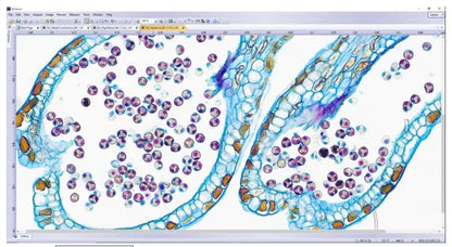OLYMPUS LC35 Digital Microscope Camera
